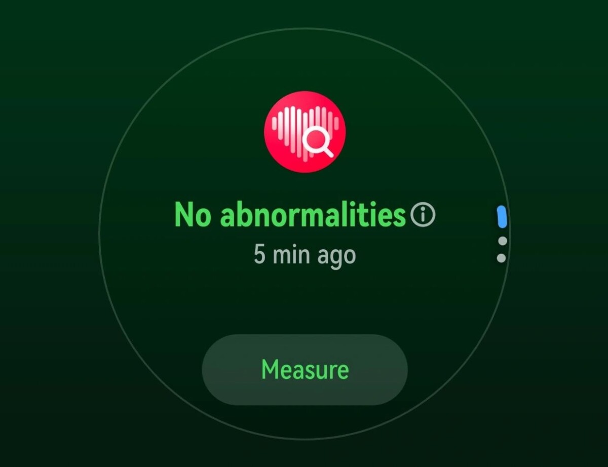 HUAWEI Watch GT 6 okosóra aritmia
