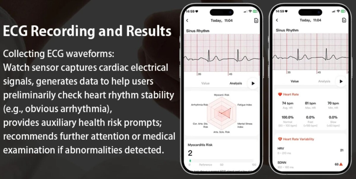 BlitzWolf HL7 EKG okosóra