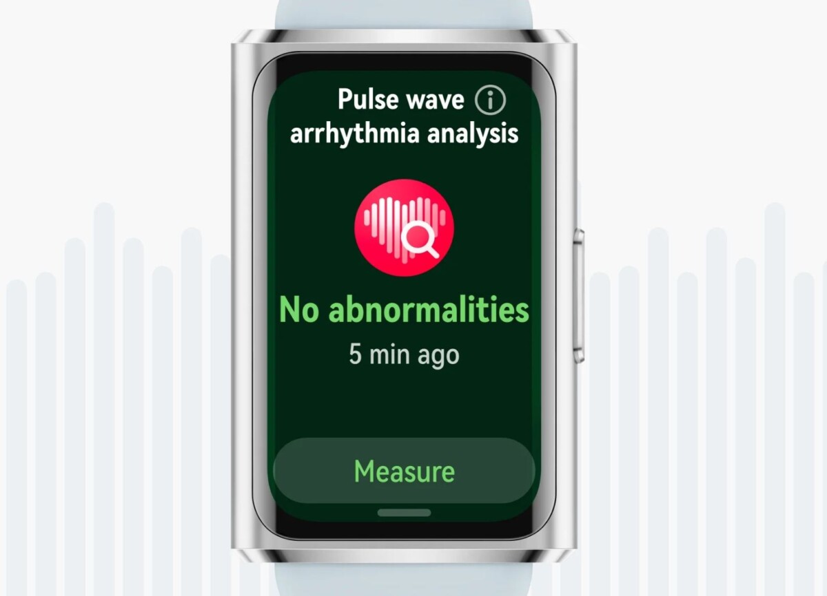 HUAWEI Band 11 Pro szívritmuszavar előrejelzés