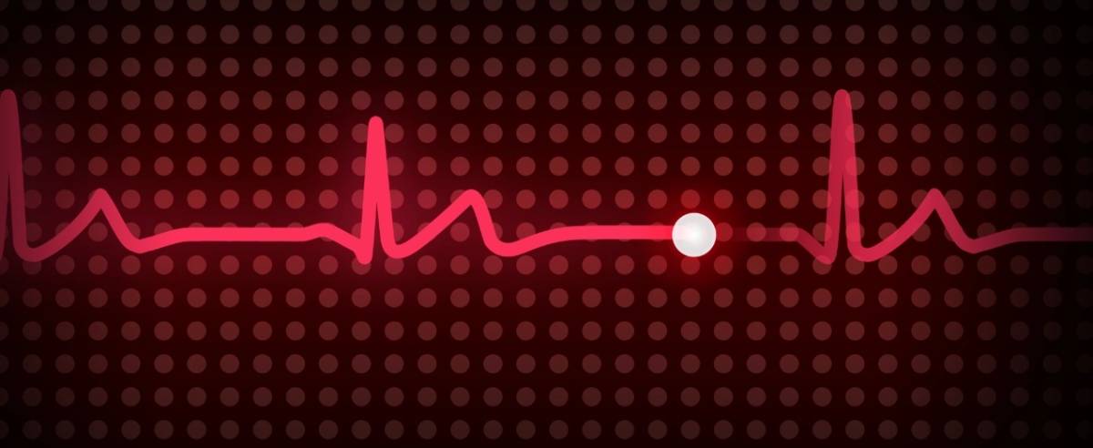 HUAWEI WATCH GT 6 Pro EKG