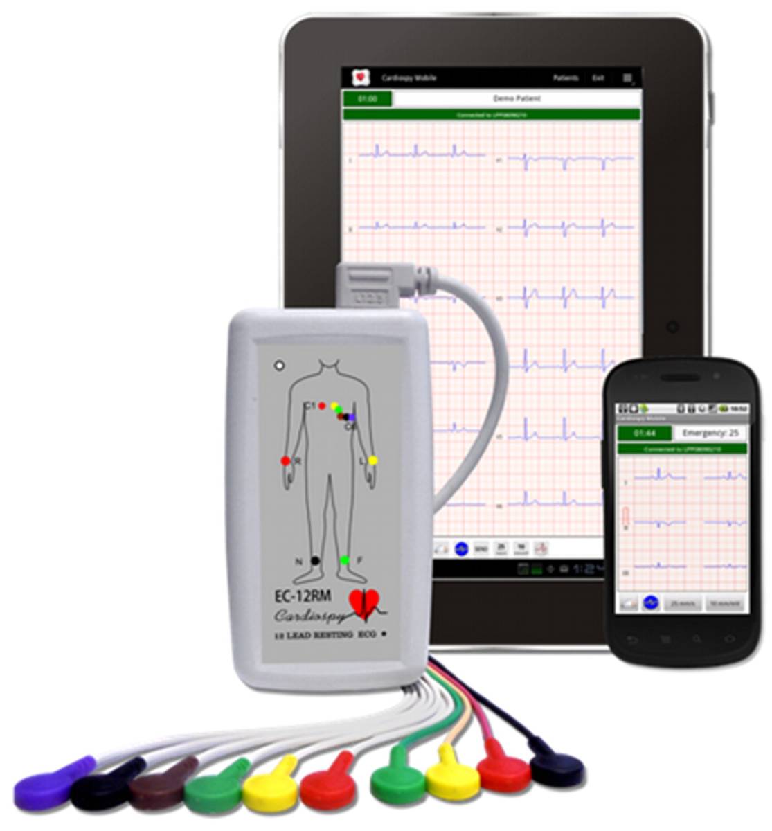 EKG