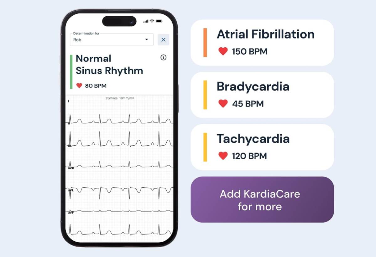 KardiaMobile 6L hordozható EKG vizsgálat eredménye